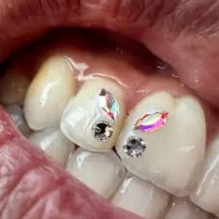 In Person Lash Extension & Tooth Gem Training Bundle (2-Days)