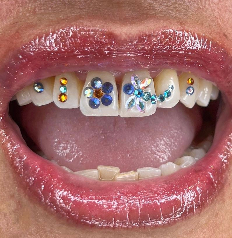 Online Tooth Gem Technician Training