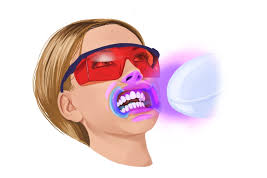 Online Teeth Whitening & Tooth Gem Bundle