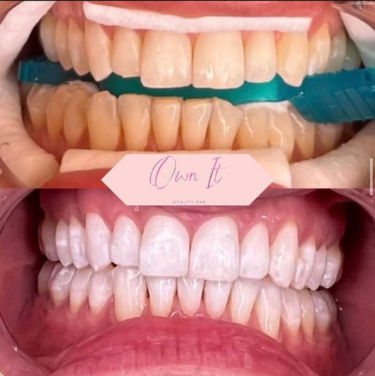 In Person Teeth Whitening & Tooth Gem Training Bundle (1-Day)